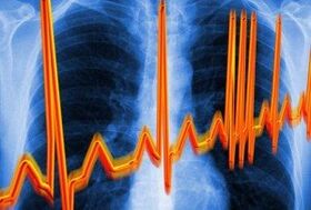 Herzrhythmie gegen Osteochondrose